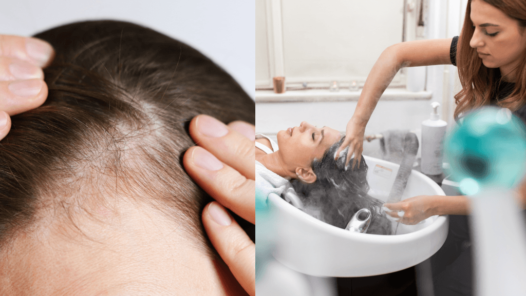 Matu stiliste: “Sievietes nāk ar vienu un to pašu problēmu. Un katrai es saku to pašu – šampūns jūs neizglābs.”